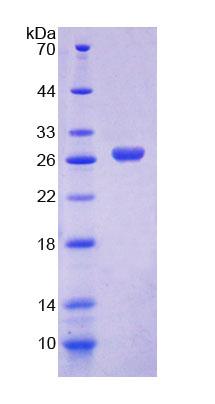 Recombinant Glutaminyl tRNA Synthetase (QARS)