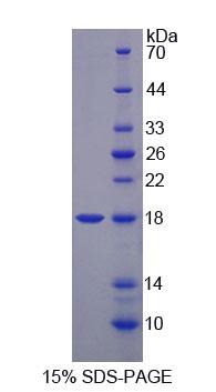 Recombinant Methionyl tRNA Synthetase (MARS)