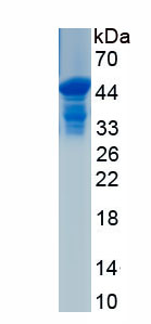 Recombinant Follicle Stimulating Hormone Beta (FSHb)