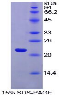 Recombinant Ferritin, Light Polypeptide (FTL)