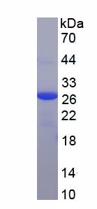 Recombinant Ferritin, Heavy Polypeptide (FTH)