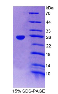 Recombinant Ferritin, Heavy Polypeptide (FTH)