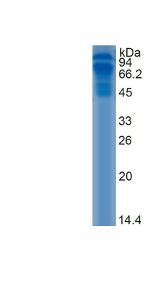 Recombinant Ryanodine Receptor 2, Cardiac (RYR2)