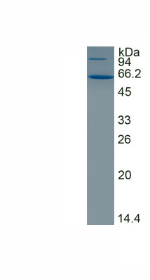 Recombinant Ryanodine Receptor 2, Cardiac (RYR2)