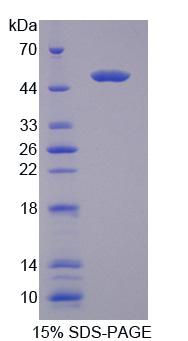 Recombinant Triadin (TRDN)