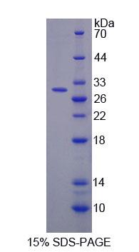 Recombinant Triadin (TRDN)