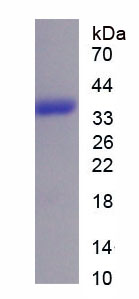 Recombinant Glucagon Like Peptide 2 (GLP2)