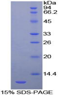 Recombinant Heat Shock 70kDa Protein 8 (HSPA8)