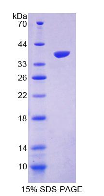 Recombinant Apelin (APLN)