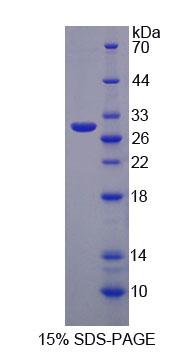 Recombinant Membrane Protein, Palmitoylated 3 (MPP3)