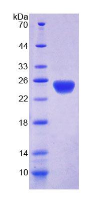 Recombinant Discs, Large Homolog 5 (DLG5)