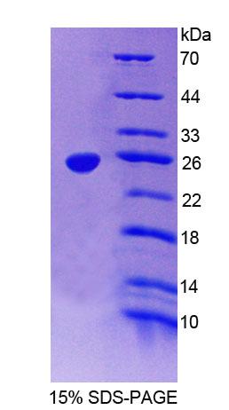 Recombinant Discs, Large Homolog 5 (DLG5)