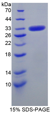 Recombinant Carbonic Anhydrase VB, Mitochondrial (CA5B)