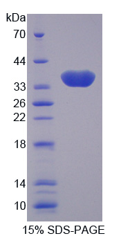 Recombinant Carbonic Anhydrase VIII (CA8)