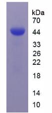 Recombinant Carbonic Anhydrase IX (CA9)