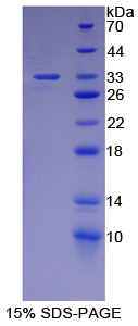 Recombinant Carbonic Anhydrase XII (CA12)