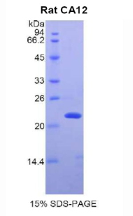 Recombinant Carbonic Anhydrase XII (CA12)