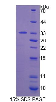 Recombinant Carbonic Anhydrase XIII (CA13)