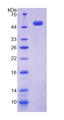 Recombinant Acid Phosphatase 6, Lysophosphatidic (ACP6)