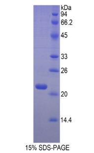 Recombinant Hemoglobin Beta (HBb)