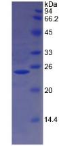 Recombinant Hemoglobin Beta (HBb)