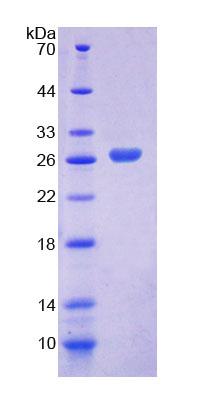Recombinant Low Density Lipoprotein Receptor Related Protein 1B (LRP1B)