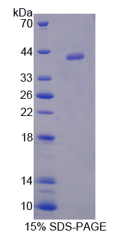 Recombinant Low Density Lipoprotein Receptor Adaptor Protein 1 (LDLRAP1)