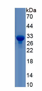 Recombinant Kallikrein 2 (KLK2)