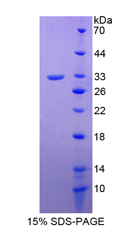 Recombinant Gastric Intrinsic Factor (GIF)