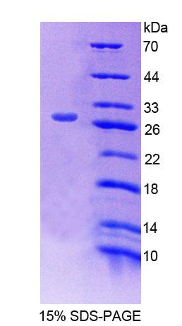Recombinant Antigen Peptide Transporter 2 (TAP2)