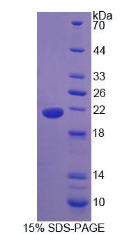 Recombinant Hedgehog Homolog, Indian (IHH)