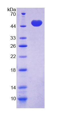 Recombinant Liver X Receptor Beta (LXRb)