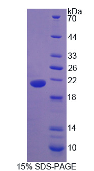 Recombinant Urocortin 3 (UCN3)