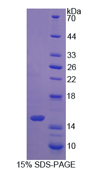 Recombinant S100 Calcium Binding Protein A16 (S100A16)