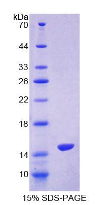 Recombinant S100 Calcium Binding Protein Z (S100Z)
