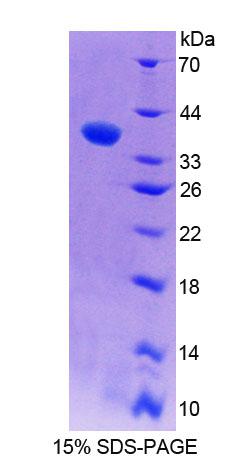 Recombinant Ribonuclease H2 Subunit A (RNASEH2A)