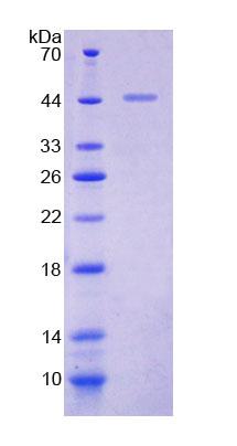 Recombinant Glycogen Debranching Enzyme (AGL)