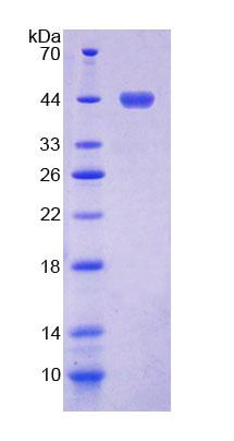 Recombinant Sjogren Syndrome Antigen A2 (SSA2)