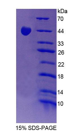 Recombinant Sjogren Syndrome Antigen A2 (SSA2)