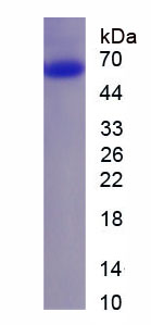 Recombinant Sequestosome 1 (SQSTM1)