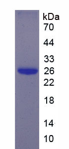 Recombinant Epstein Barr Virus Induced Protein 3 (EBI3)