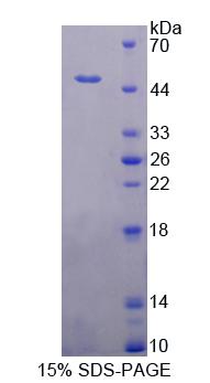 Recombinant Troponin C Type 1, Slow (TNNC1)