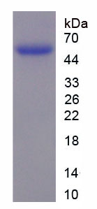 Recombinant Troponin T Type 2, Cardiac (TNNT2)