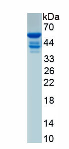 Recombinant Troponin T Type 2, Cardiac (TNNT2)