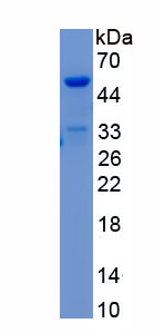 Recombinant Troponin T Type 2, Cardiac (TNNT2)