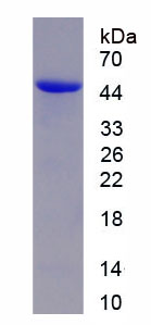 Recombinant Calmodulin 1 (CALM1)