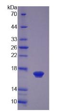 Recombinant Left/Right Determination Factor 2 (LEFTY2)