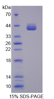 Recombinant Aldolase B, Fructose Bisphosphate (ALDOB)