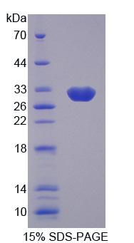 Recombinant Aldolase C, Fructose Bisphosphate (ALDOC)