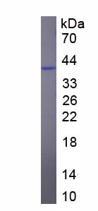 Recombinant Amiloride Sensitive Sodium Channel Subunit Gamma (SCNN1g)